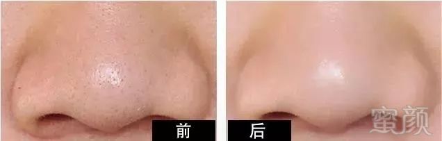 https://img.miyanlife.com/mnt/timg/181004/11095510Z-3.jpg