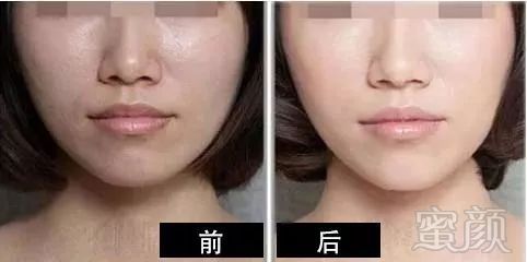 https://img.miyanlife.com/mnt/timg/181004/1109552W7-6.jpg