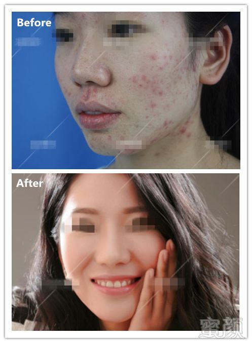 https://img.miyanlife.com/mnt/timg/181004/11131T506-9.jpg