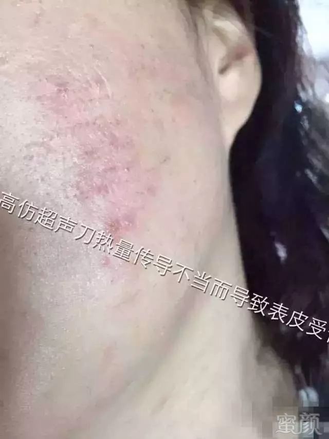 https://img.miyanlife.com/mnt/timg/181004/11162064J-2.jpg