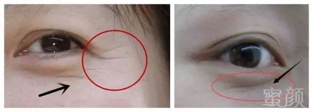 https://img.miyanlife.com/mnt/timg/181004/1116225213-5.jpg