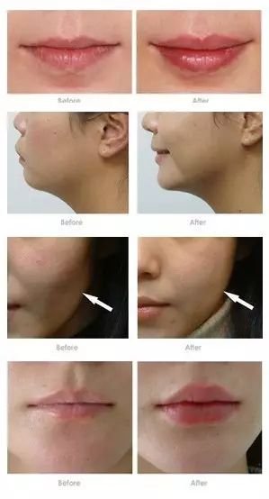 https://img.miyanlife.com/mnt/timg/181004/11241UD9-6.jpg