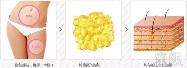 https://img.miyanlife.com/mnt/timg/181004/1125002V7-3.jpg