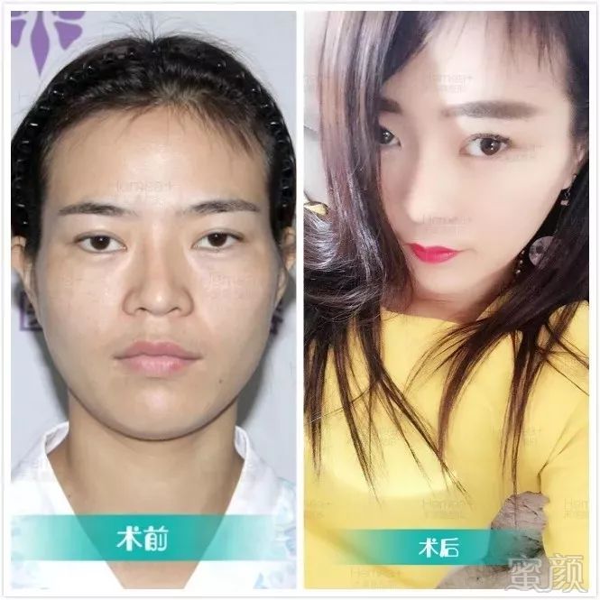 https://img.miyanlife.com/mnt/timg/181004/1125011B6-6.jpg