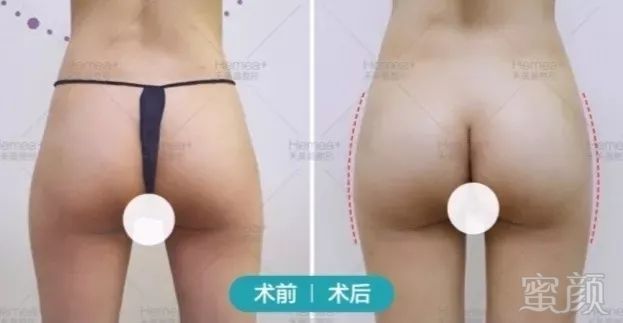https://img.miyanlife.com/mnt/timg/181004/1125013107-7.jpg
