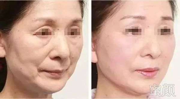 https://img.miyanlife.com/mnt/timg/181004/113U51K8-7.jpg