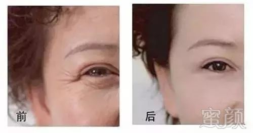 https://img.miyanlife.com/mnt/timg/181004/113U550I-8.jpg