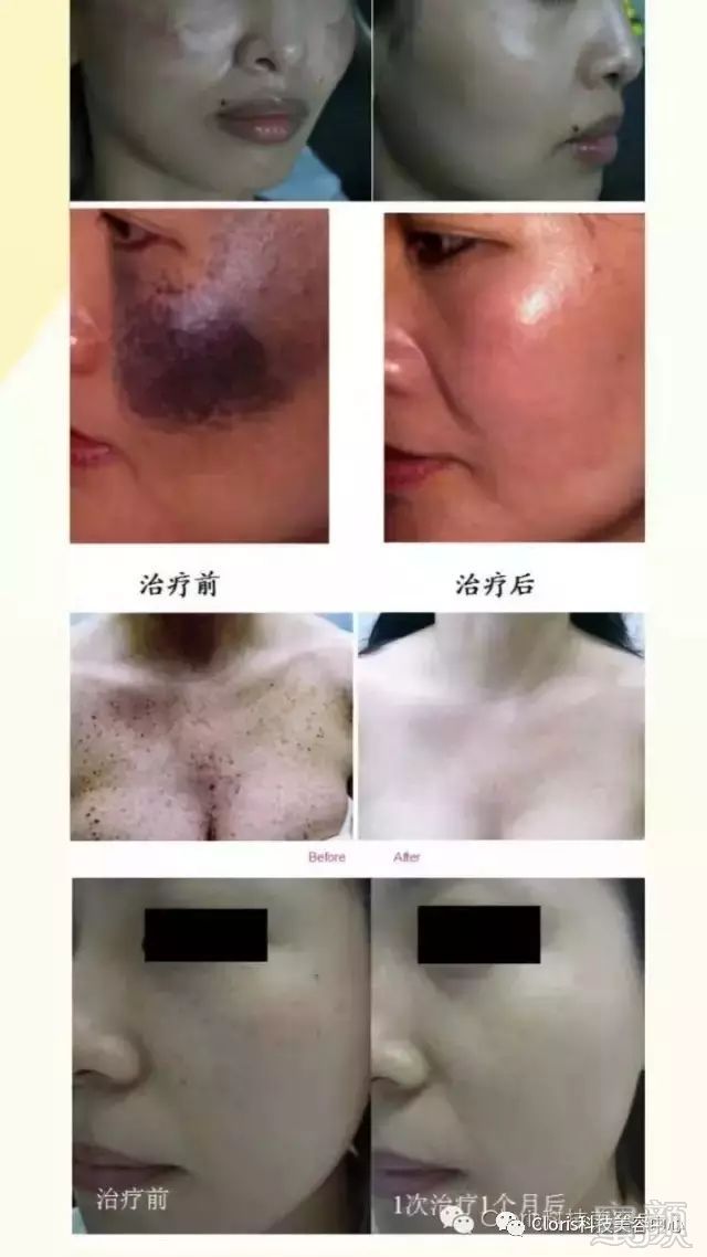 https://img.miyanlife.com/mnt/timg/181004/114I0GC-6.jpg