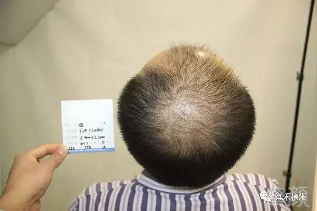 https://img.miyanlife.com/mnt/timg/181005/105F64152-1.jpg