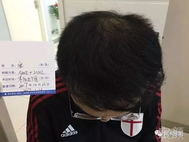 https://img.miyanlife.com/mnt/timg/181005/105F95147-6.jpg