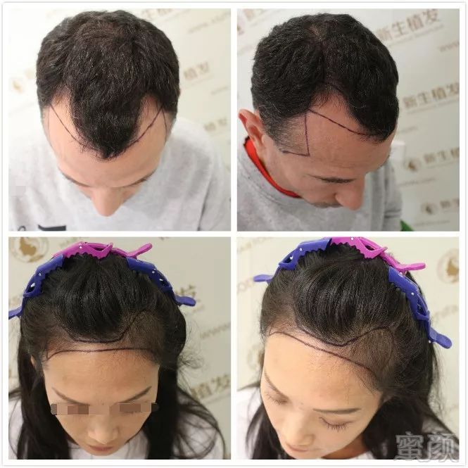 https://img.miyanlife.com/mnt/timg/181005/1104091391-1.jpg