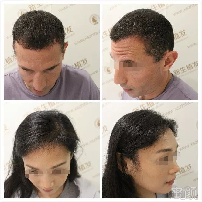 https://img.miyanlife.com/mnt/timg/181005/11041015F-3.jpg