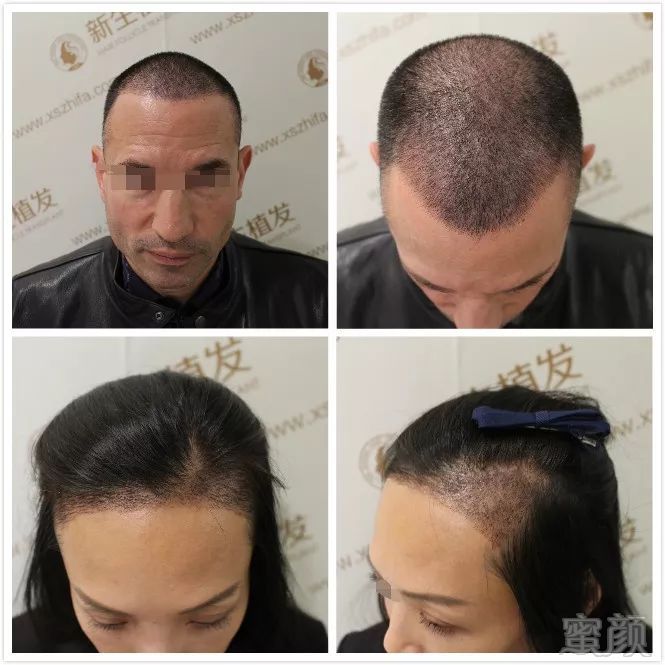 https://img.miyanlife.com/mnt/timg/181005/110410HT-2.jpg