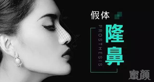 https://img.miyanlife.com/mnt/timg/181005/1110302G4-0.jpg