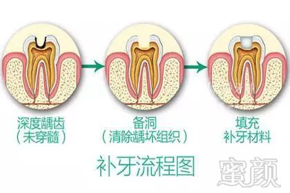 https://img.miyanlife.com/mnt/timg/181005/11193G306-3.jpg