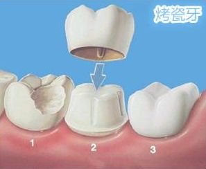 https://img.miyanlife.com/mnt/timg/181005/11193Q939-12.jpg