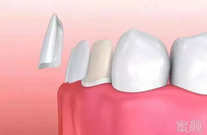 https://img.miyanlife.com/mnt/timg/181005/11193SG3-11.jpg