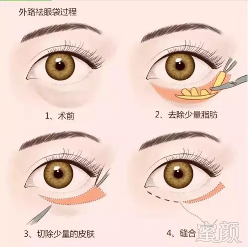 https://img.miyanlife.com/mnt/timg/181005/111I140T-7.jpg
