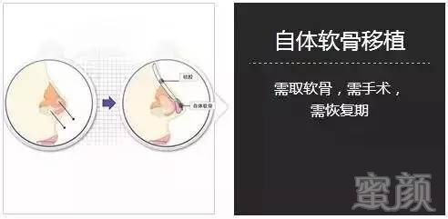 https://img.miyanlife.com/mnt/timg/181005/1120301545-5.jpg