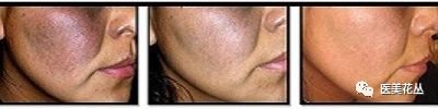https://img.miyanlife.com/mnt/timg/181005/11310QE1-3.jpg