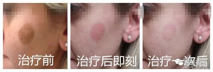 https://img.miyanlife.com/mnt/timg/181005/11310T037-2.jpg