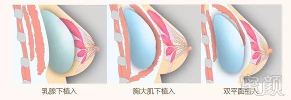 https://img.miyanlife.com/mnt/timg/181005/11344935G-2.jpg