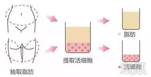 https://img.miyanlife.com/mnt/timg/181005/1134521H8-5.jpg