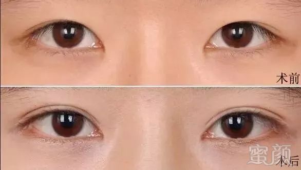 https://img.miyanlife.com/mnt/timg/181005/1142511N3-1.jpg