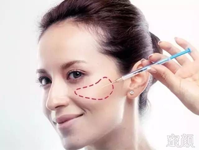 https://img.miyanlife.com/mnt/timg/181005/11440034M-10.jpg