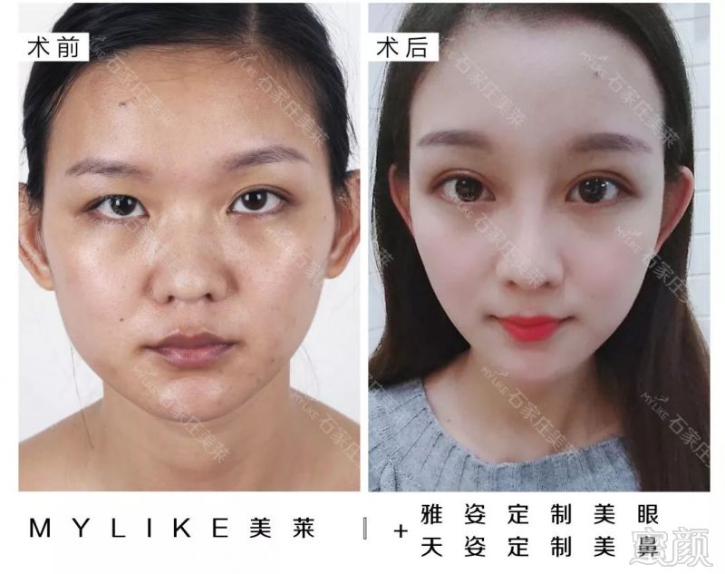 https://img.miyanlife.com/mnt/timg/181005/11440124A-4.jpg