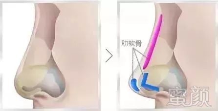 https://img.miyanlife.com/mnt/timg/181005/114HL555-1.jpg