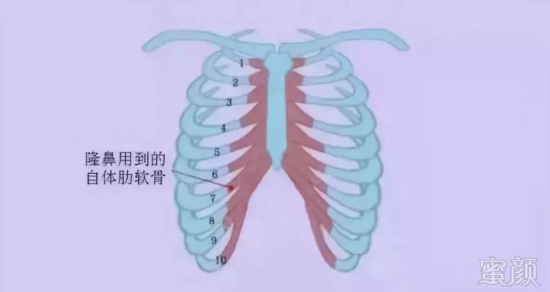 https://img.miyanlife.com/mnt/timg/181005/114T25a2-5.jpg