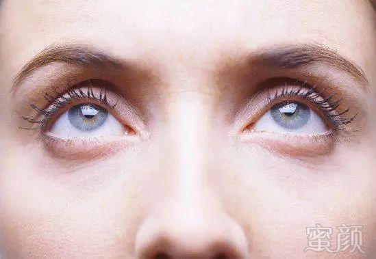 https://img.miyanlife.com/mnt/timg/181005/1150244A7-5.jpg