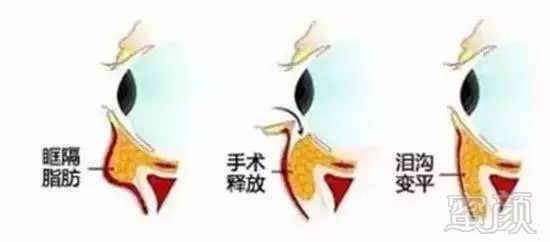 https://img.miyanlife.com/mnt/timg/181005/115025O31-8.jpg