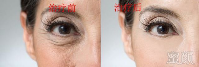 https://img.miyanlife.com/mnt/timg/181005/11502B9B-10.jpg