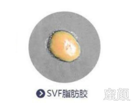 https://img.miyanlife.com/mnt/timg/181005/11502CH5-11.jpg