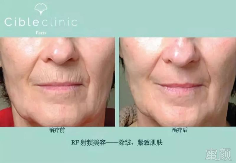 https://img.miyanlife.com/mnt/timg/181006/103G33055-5.jpg