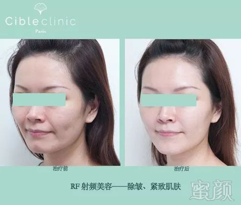 https://img.miyanlife.com/mnt/timg/181006/103G3G37-4.jpg