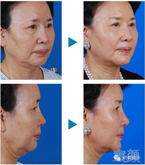 https://img.miyanlife.com/mnt/timg/181006/103J41E5-2.jpg