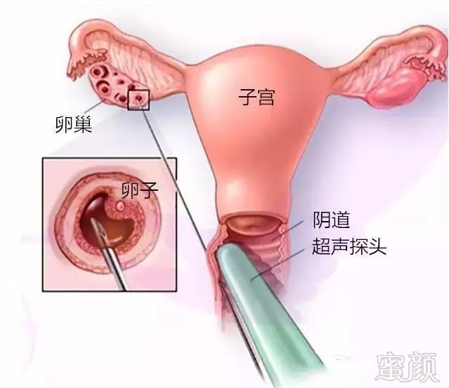 https://img.miyanlife.com/mnt/timg/181006/10403M236-1.jpg