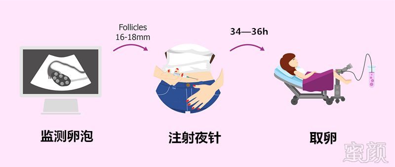 https://img.miyanlife.com/mnt/timg/181006/1041004262-10.jpg