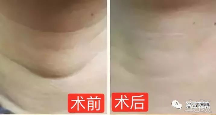 https://img.miyanlife.com/mnt/timg/181006/10424R259-10.jpg