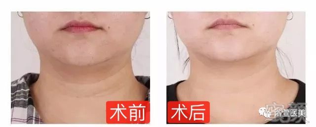 https://img.miyanlife.com/mnt/timg/181006/10424VG7-9.jpg