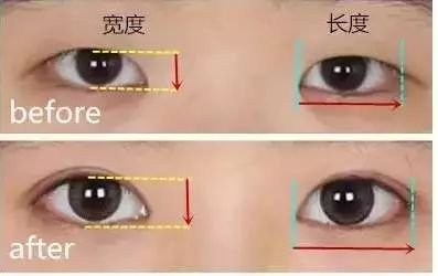 https://img.miyanlife.com/mnt/timg/181006/1049521Q6-6.jpg