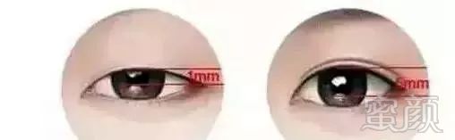 https://img.miyanlife.com/mnt/timg/181006/1049531060-8.jpg