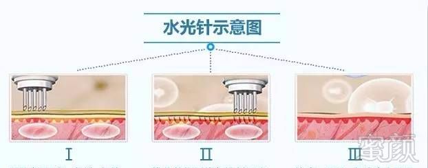 https://img.miyanlife.com/mnt/timg/181006/1056333147-6.jpg