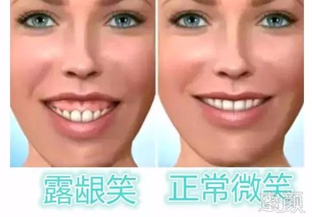 https://img.miyanlife.com/mnt/timg/181006/1056336308-14.jpg