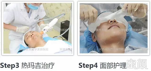 https://img.miyanlife.com/mnt/timg/181006/105R15a9-4.jpg