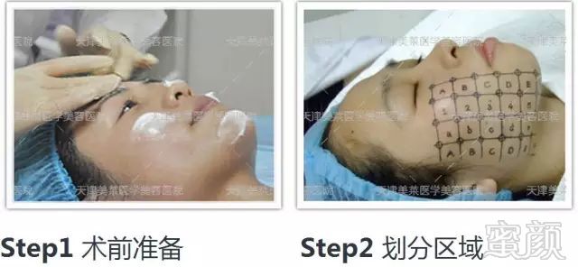 https://img.miyanlife.com/mnt/timg/181006/105R161O-3.jpg