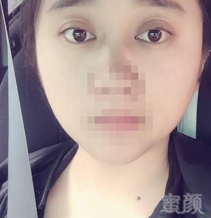https://img.miyanlife.com/mnt/timg/181006/11062KU6-4.jpg